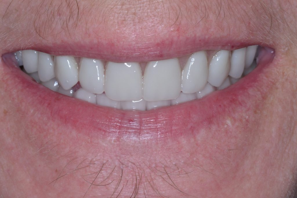 customer's smile after they went to jim kotsianas the dentist knoxville trusts